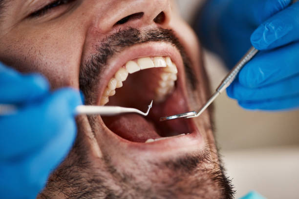 Best Emergency Tooth Extraction  in Mount Oliver, PA